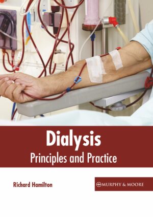 Dialysis: Principles And Practice