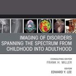 Imaging Of Disorders Spanning The Spectrum From Childhood, An Issue Of Radiologic Clinics Of North America (58.3)