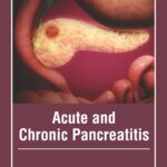 Acute And Chronic Pancreatitis
