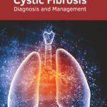 Cystic Fibrosis: Diagnosis And Management