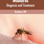 Malaria: Diagnosis And Treatment