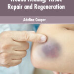 Wound Healing, Tissue Repair And Regeneration