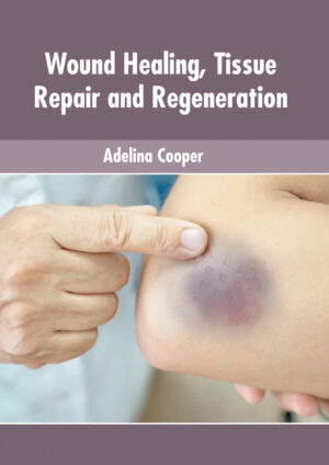 Wound Healing, Tissue Repair And Regeneration