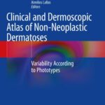 Clinical And Dermoscopic Atlas Of Non-neoplastic Dermatoses Variability According To Phototypes