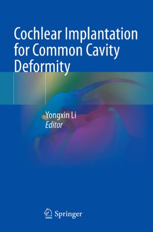 Cochlear Implantation For Common Cavity Deformity